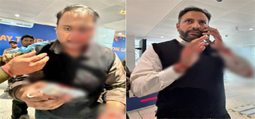 दिल्ली एयरपोर्ट: पैसेंजर को पीटने वाले पायलट पर FIR, पुलिस ने हिरासत में लिया; पीड़ित की नाक टूटी